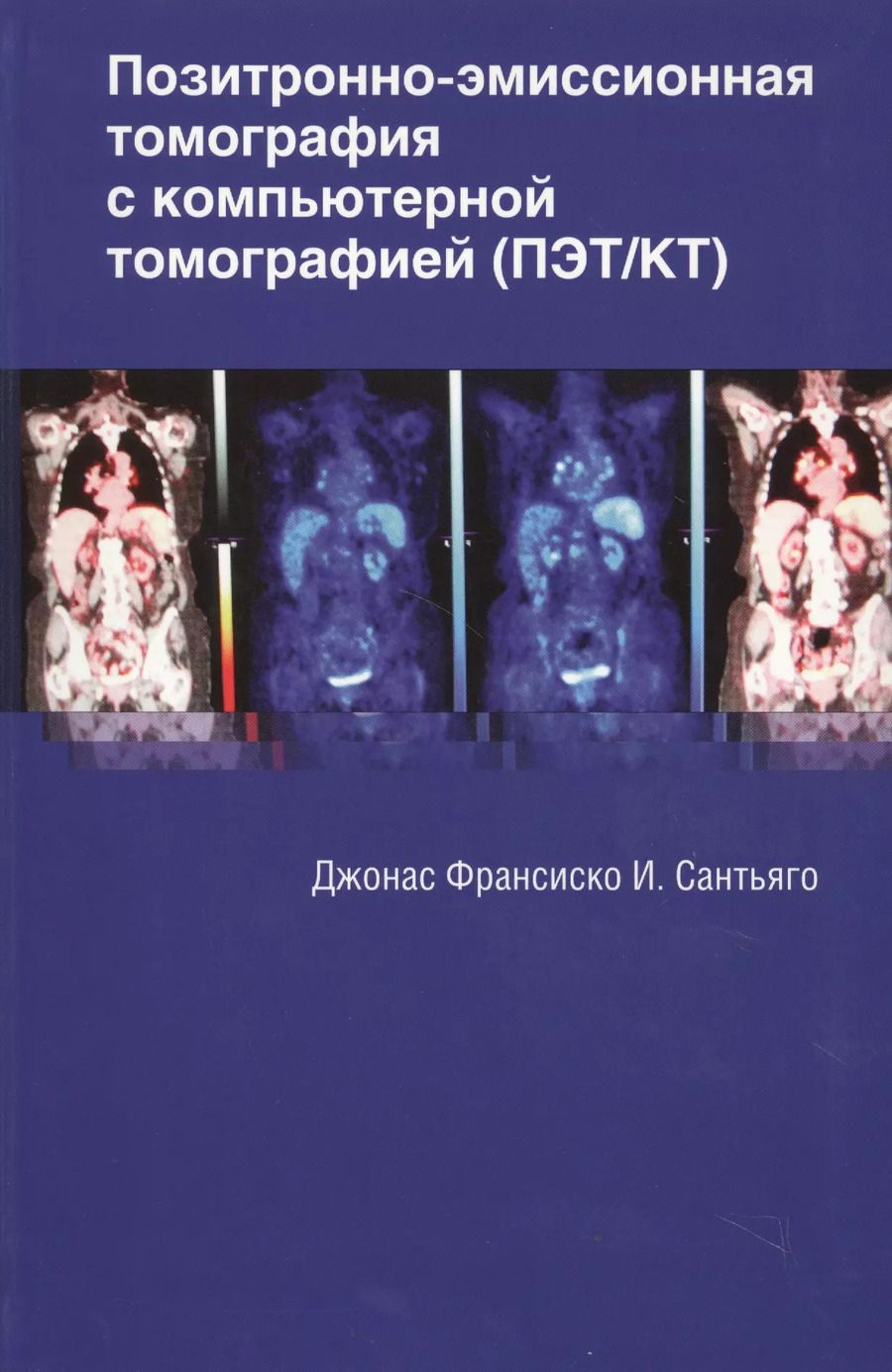 Обложка книги "Джонас Сантьяго: Позитронно-эмиссионная томография с компьютерной томографией (ПЭТ/КТ)"