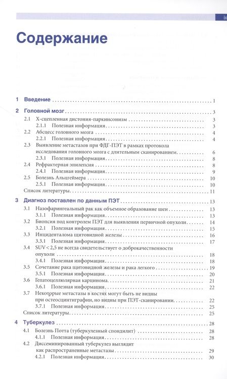 Фотография книги "Джонас Сантьяго: Позитронно-эмиссионная томография с компьютерной томографией (ПЭТ/КТ)"