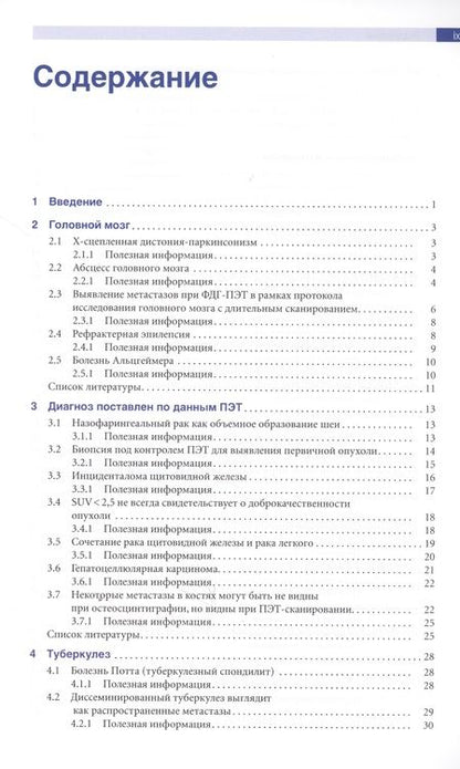 Фотография книги "Джонас Сантьяго: Позитронно-эмиссионная томография с компьютерной томографией (ПЭТ/КТ)"