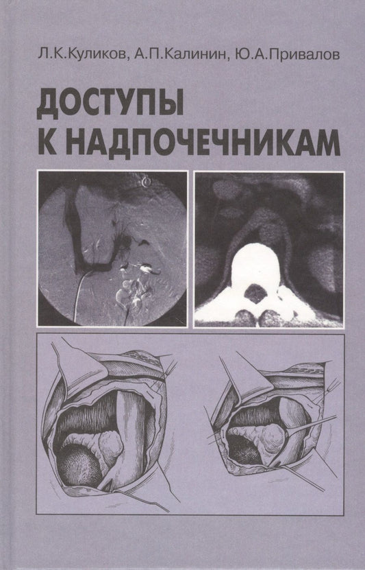 Обложка книги "Куликов: Доступы к надпочечникам. Руководство для врачей"