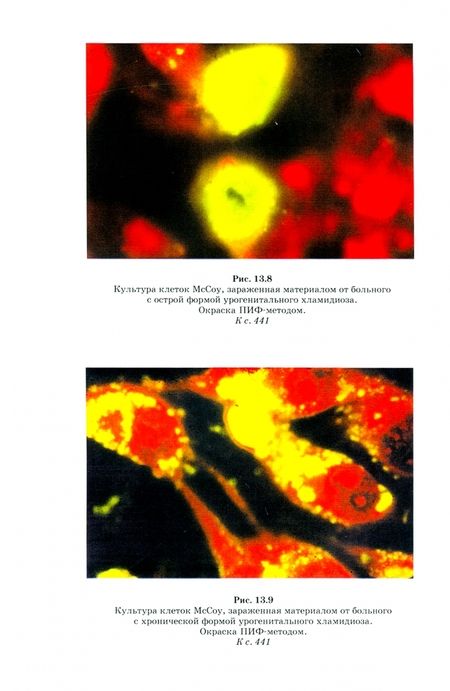Фотография книги "Лабинская, Блинкова, Ещина: Частная медицинская микробиология с техникой микробиологических исследований"