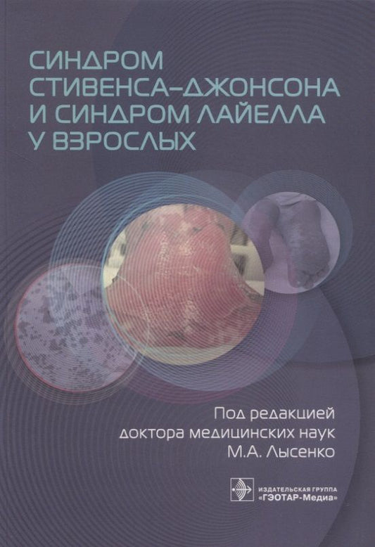 Обложка книги "Лысенко, Фомина, Проценко: Синдром Стивенса-Джонсона и синдром Лайелла у взрослых"
