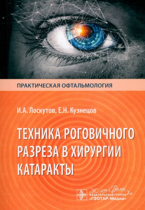 Обложка книги "Лоскутов, Кузнецов: Техника роговичного разреза в хирургии катаракты"