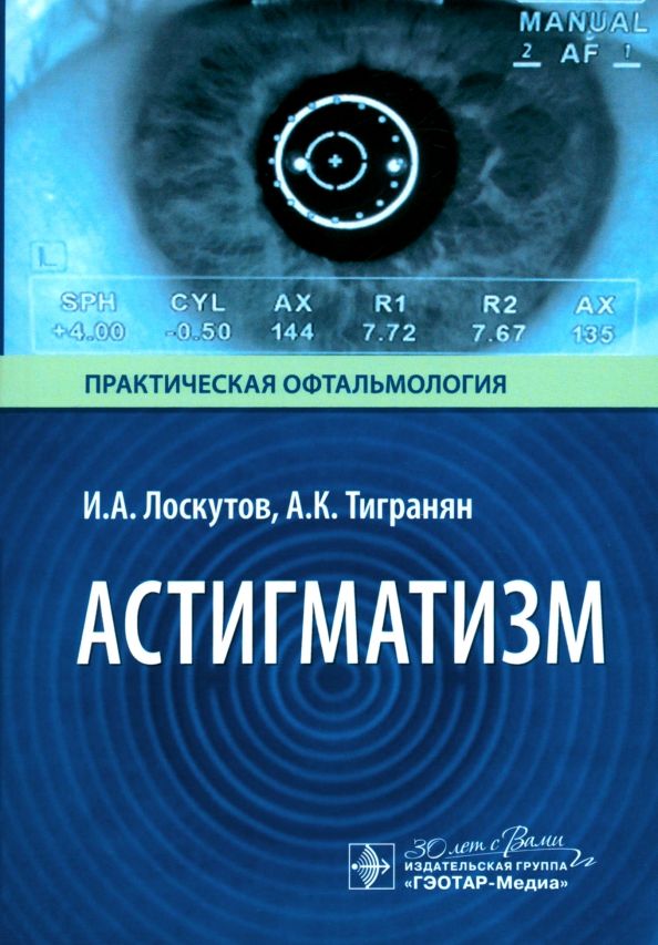 Обложка книги "Лоскутов, Тигранян: Астигматизм"