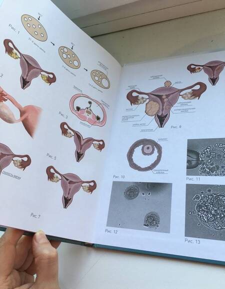 Фотография книги "Мария Якимова: Если аист затерялся... Доступно об ЭКО"
