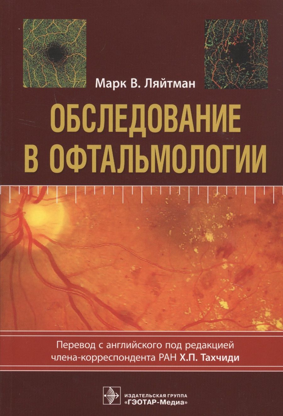 Обложка книги "Марк В.: Обследование в офтальмологии"