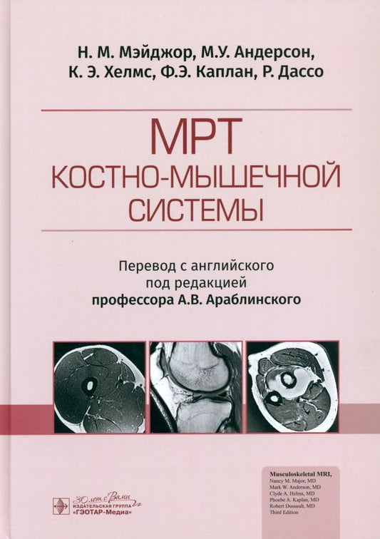 Обложка книги "Мэйджор, Андерсон, Хелмс: МРТ костно-мышечной системы"