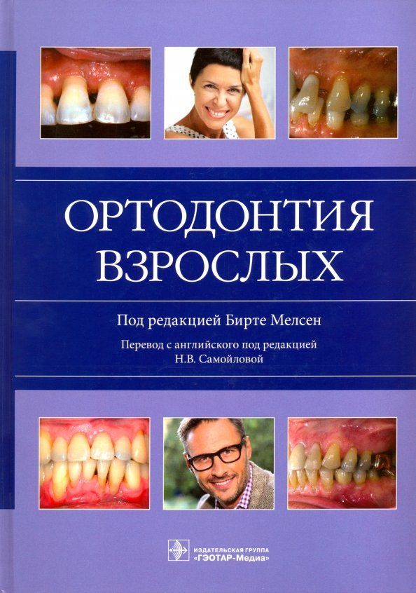 Обложка книги "Мелсен, Аллаис, Биндслев: Ортодонтия взрослых"