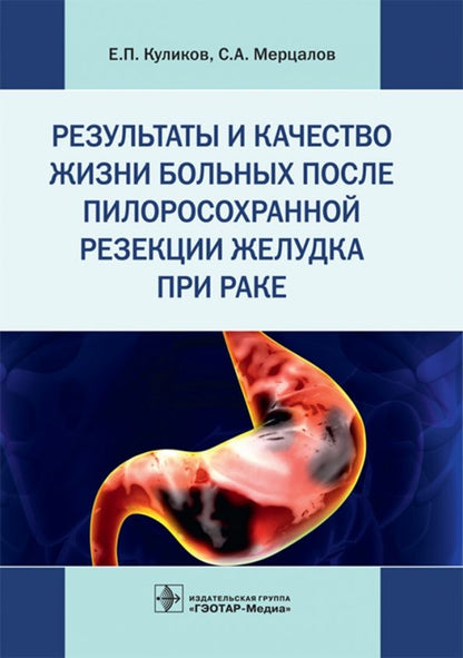 Обложка книги "Мерцалов, Куликов: Результаты и качество жизни больных после пилоросохранной резекции желудка при раке"