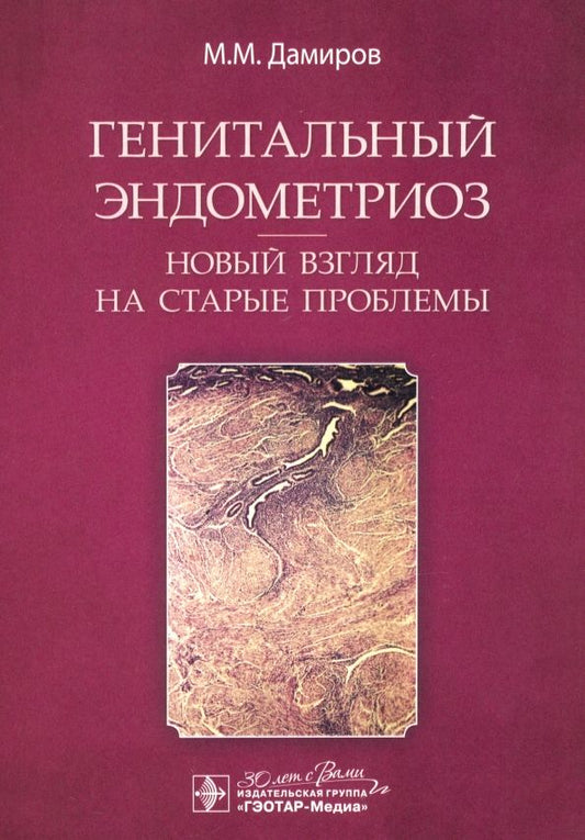 Обложка книги "Михаил Дамиров: Генитальный эндометриоз. Новый взгляд на старые проблемы"
