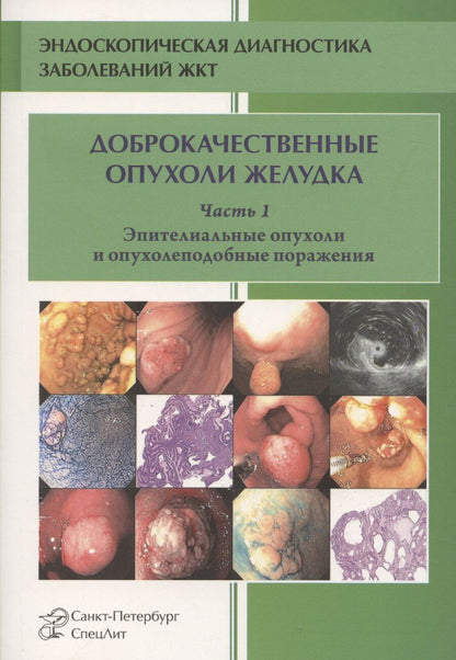 Обложка книги "Михаил Кузин: Доброкачественные опухоли желудка. Часть 1. Эпителиальные опухоли и опухолеподобные поражения. Учебно-методическое пособие"