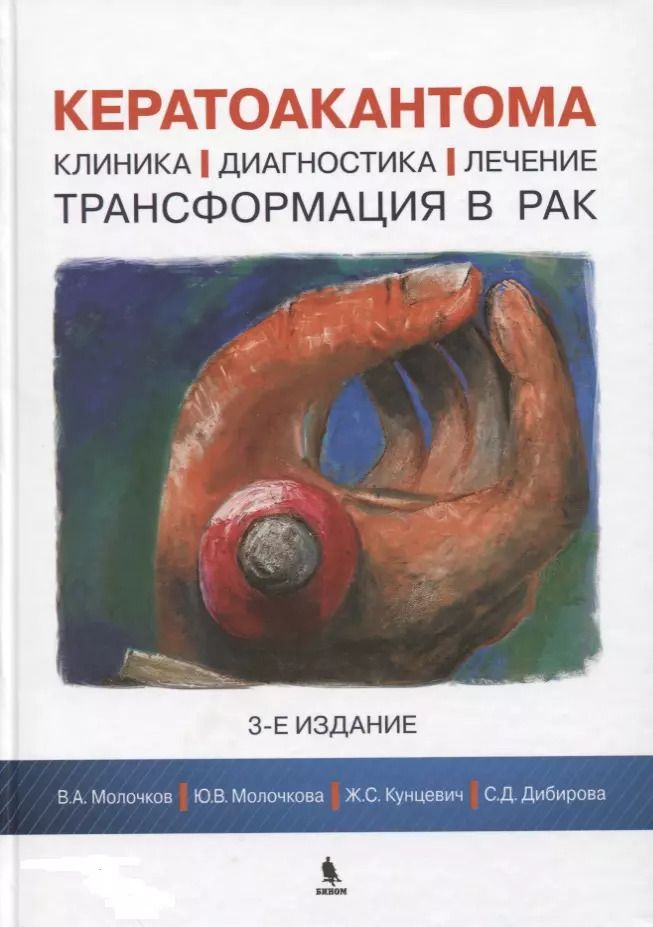 Обложка книги "Молочков, Молочкова, Кунцевич, Дибирова: Кератоакантома. Клиника, диагностика, лечение, трансформация в рак. 3-е издание"