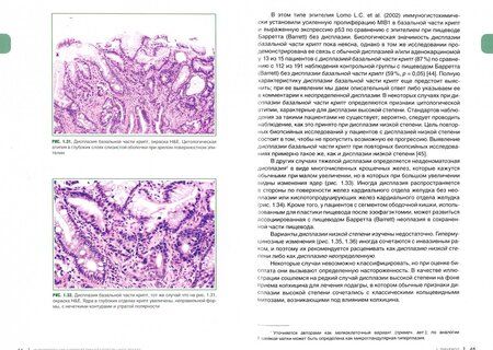 Фотография книги "Монтгомери, Вольтаджо: Интерпретация биопсий пищеварительного тракта. Том 2. Новообразования"
