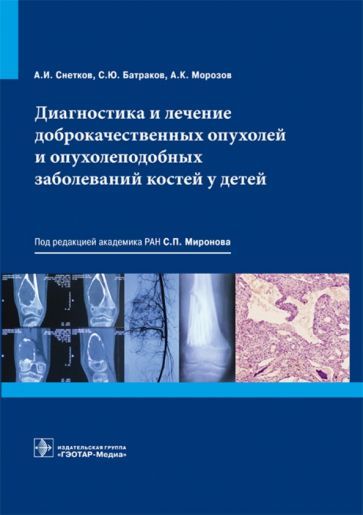 Обложка книги "Морозов, Снетков, Батраков: Диагностика и лечение доброкачественных опухолей и опухолеподобных заболеваний костей у детей"