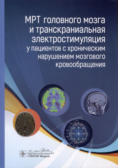 Обложка книги "Морозова, Борсуков, Чухонцева: МРТ головного мозга и транскраниальная электростимуляция у пациентов с хроническим нарушением"