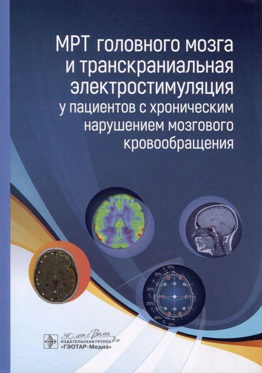 Обложка книги "Морозова, Борсуков, Чухонцева: МРТ головного мозга и транскраниальная электростимуляция у пациентов с хроническим нарушением"