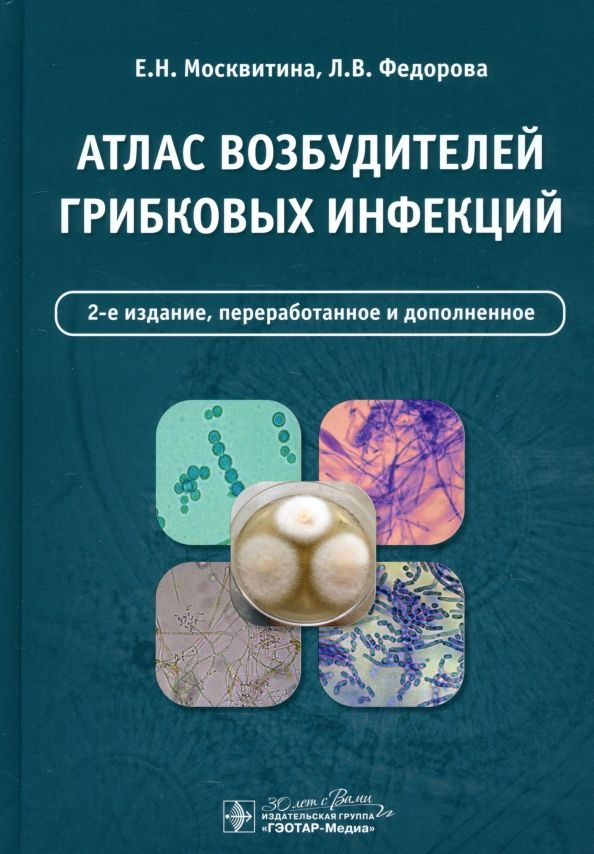 Обложка книги "Москвитина, Федорова: Атлас возбудителей грибковых инфекций"