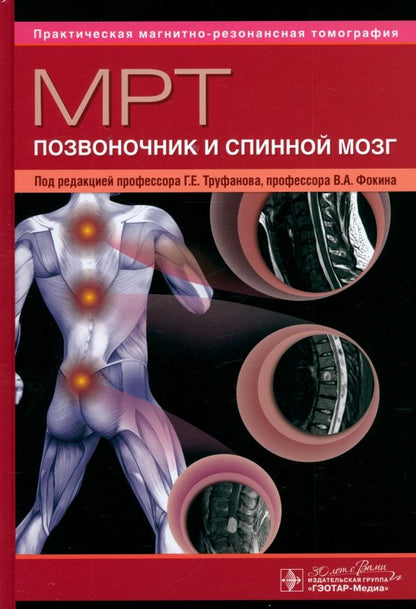Обложка книги "МРТ. Позвоночник и спинной мозг. Руководство для врачей"