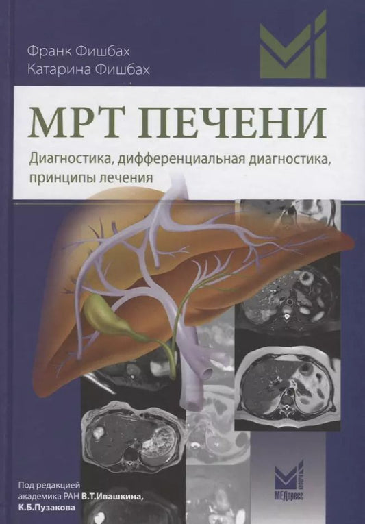 Обложка книги "МРТ печени Диагностика дифференциальная диагностика принципы лечения (Фишбах)"