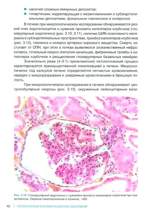 Фотография книги "Надеев, Жукова: Патологическая анатомия акушерских заболеваний"