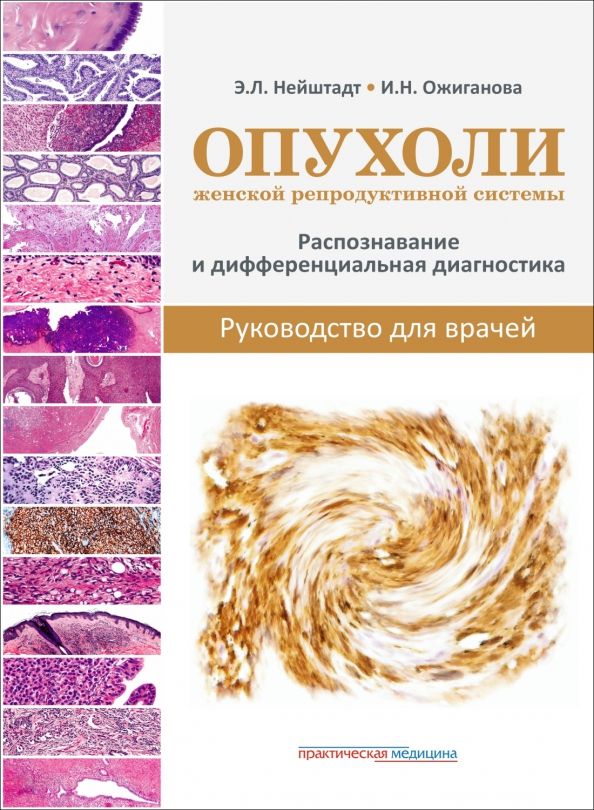 Обложка книги "Нейштадт, Ожиганова: Опухоли женской репродуктивной системы. Распознавание и дифференциальная диагностика. Руководство"