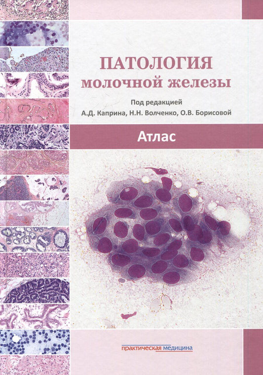 Обложка книги "Николаевна, Владимировна: Патология молочной железы. Атлас"