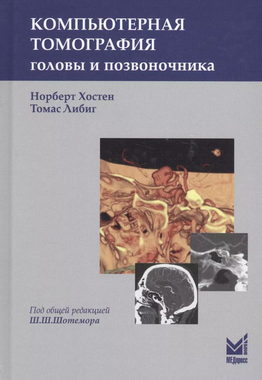 Обложка книги "Норберт Хостен: Компьютерная томография головы и позвоночника"