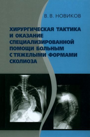 Обложка книги "Новиков: Хирургическая тактика и оказание специализированной помощи больным с тяжёлыми формами сколиоза"