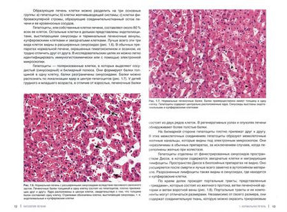 Фотография книги "О`Нил, Тэйлор, Дамьянов: Патология печени для клиницистов"