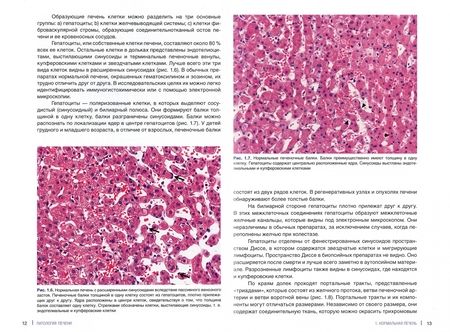 Фотография книги "О`Нил, Тэйлор, Дамьянов: Патология печени для клиницистов"