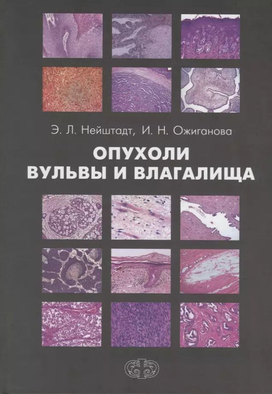 Обложка книги "Опухоли вульвы и влагалища"