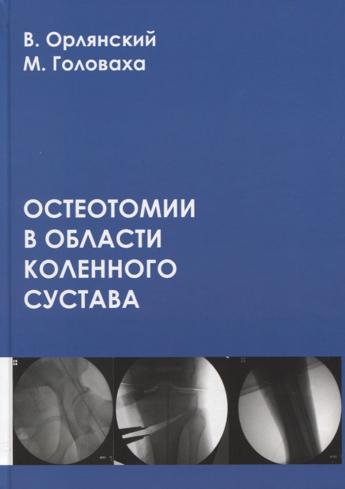 Обложка книги "Орлянский, Головаха: Остеотомии в области коленного сустава"