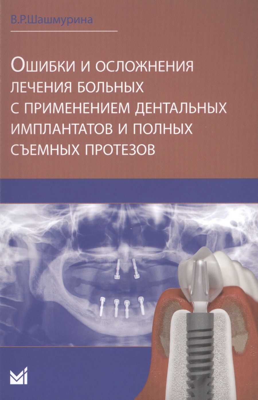 Обложка книги "Ошибки и осложнения лечения больных с применением дентальных"