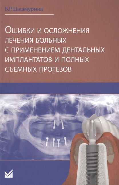 Обложка книги "Ошибки и осложнения лечения больных с применением дентальных"