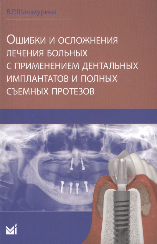 Обложка книги "Ошибки и осложнения лечения больных с применением дентальных"