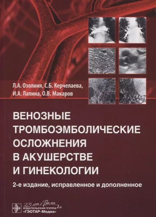 Обложка книги "Озолиня, Керчелаева, Лапина: Венозные тромбоэмболические осложнения в акушерстве"