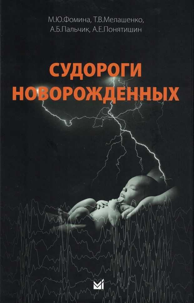 Обложка книги "Пальчик, Фомина, Мелашенко: Судороги новорожденных"