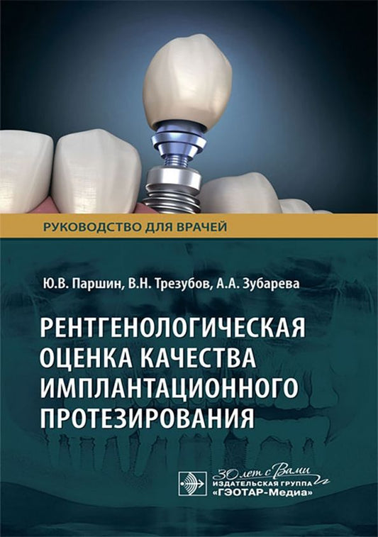 Обложка книги "Паршин, Трезубов, Зубарева: Рентгенологическая оценка качества имплантационного протезирования. Руководство"
