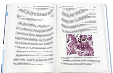 Фотография книги "Пауков, Пономарев, Федоров: Патологическая анатомия. Учебник. В 2-х томах. Том 2. Частная патология"