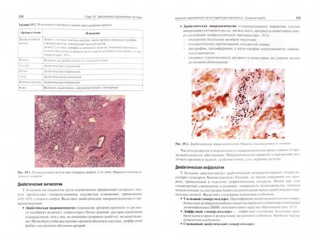 Фотография книги "Пауков, Пономарев, Федоров: Патологическая анатомия. Учебник. В 2-х томах. Том 2. Частная патология"