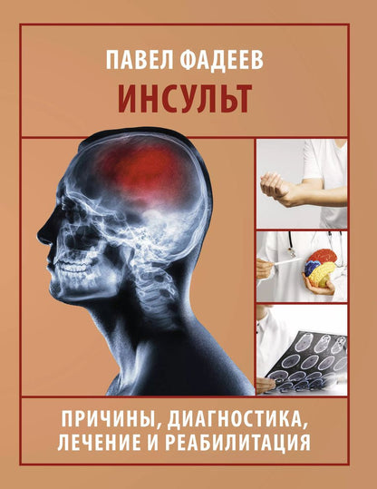 Обложка книги "Павел Фадеев: Инсульт. Причины, диагностика, лечение и реабилитация"