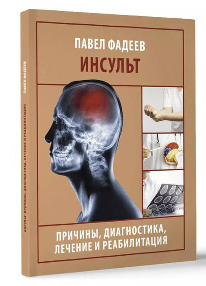 Фотография книги "Павел Фадеев: Инсульт. Причины, диагностика, лечение и реабилитация"