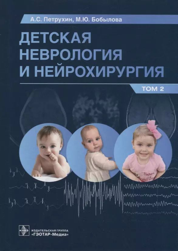 Обложка книги "Петрухин, Бобылова: Детская неврология и нейрохирургия. Учебник в 2 томах. Том 2"