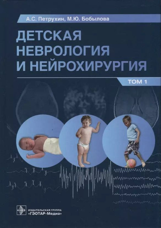 Обложка книги "Петрухин, Бобылова, Зуев: Детская неврология и нейрохирургия. Учебник в 2 томах. Том 1"