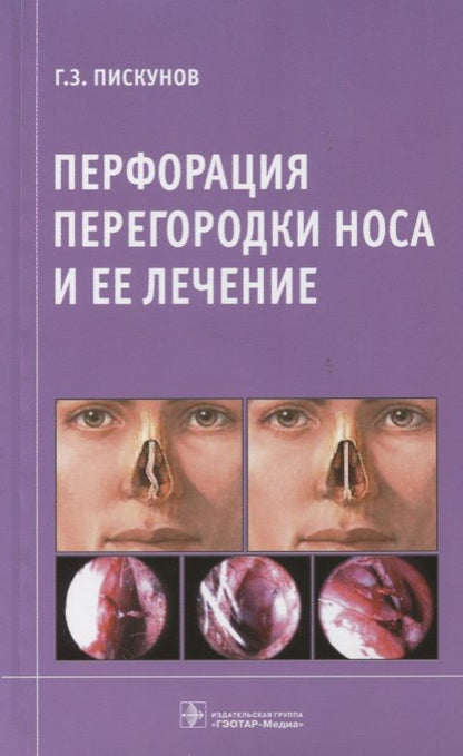 Обложка книги "Пискунов: Перфорация перегородки носа и ее лечение."
