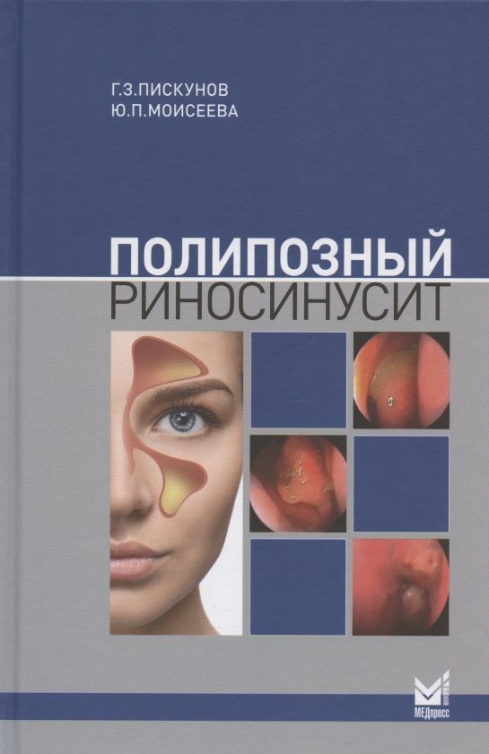 Обложка книги "Полипозный риносинусит "