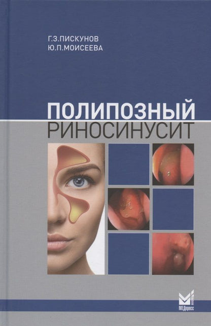 Обложка книги "Полипозный риносинусит "