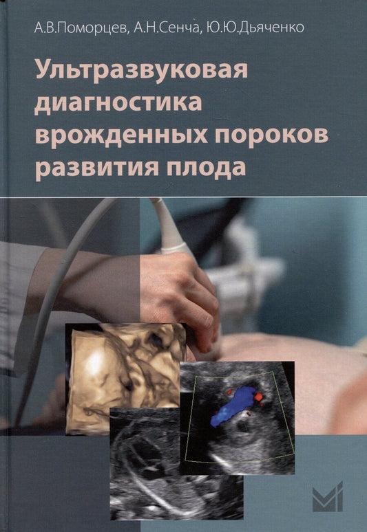 Обложка книги "Поморцев, Сенча: Ультразвуковая диагностика врожденных пороков развития плода"