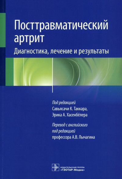 Обложка книги "Посттравматический артрит. Диагностика, лечение и результаты"