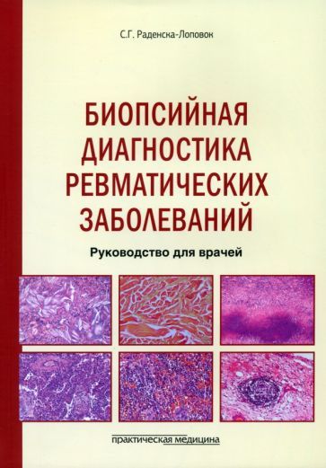 Обложка книги "Раденска-Лоповок: Биопсийная диагностика ревматических заболеваний. Руководство для врачей"
